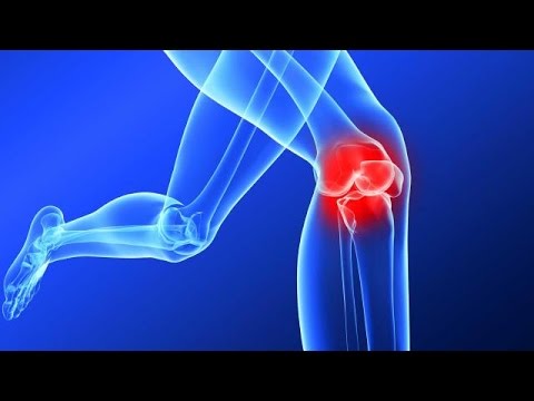How to prevent an ACL injury